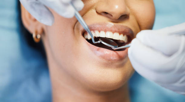 Best Emergency Treatment for Oral Infections in Mountain View Acres, CA