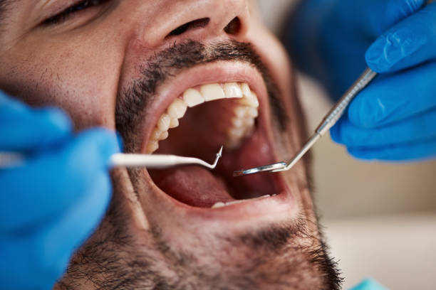 Best Urgent Dental Care for Toothaches in Mountain View Acres, CA